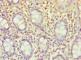 Polyclonal Rabbit anti-Human ECE2 Antibody (aa1-160, IHC)