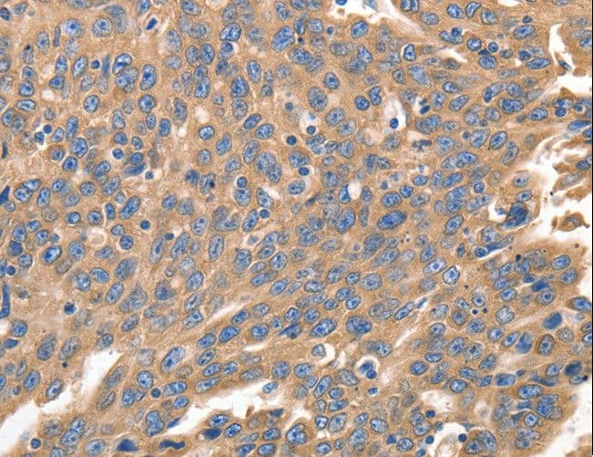 Polyclonal Rabbit anti-Human IRF1 / MAR Antibody (IHC, WB)