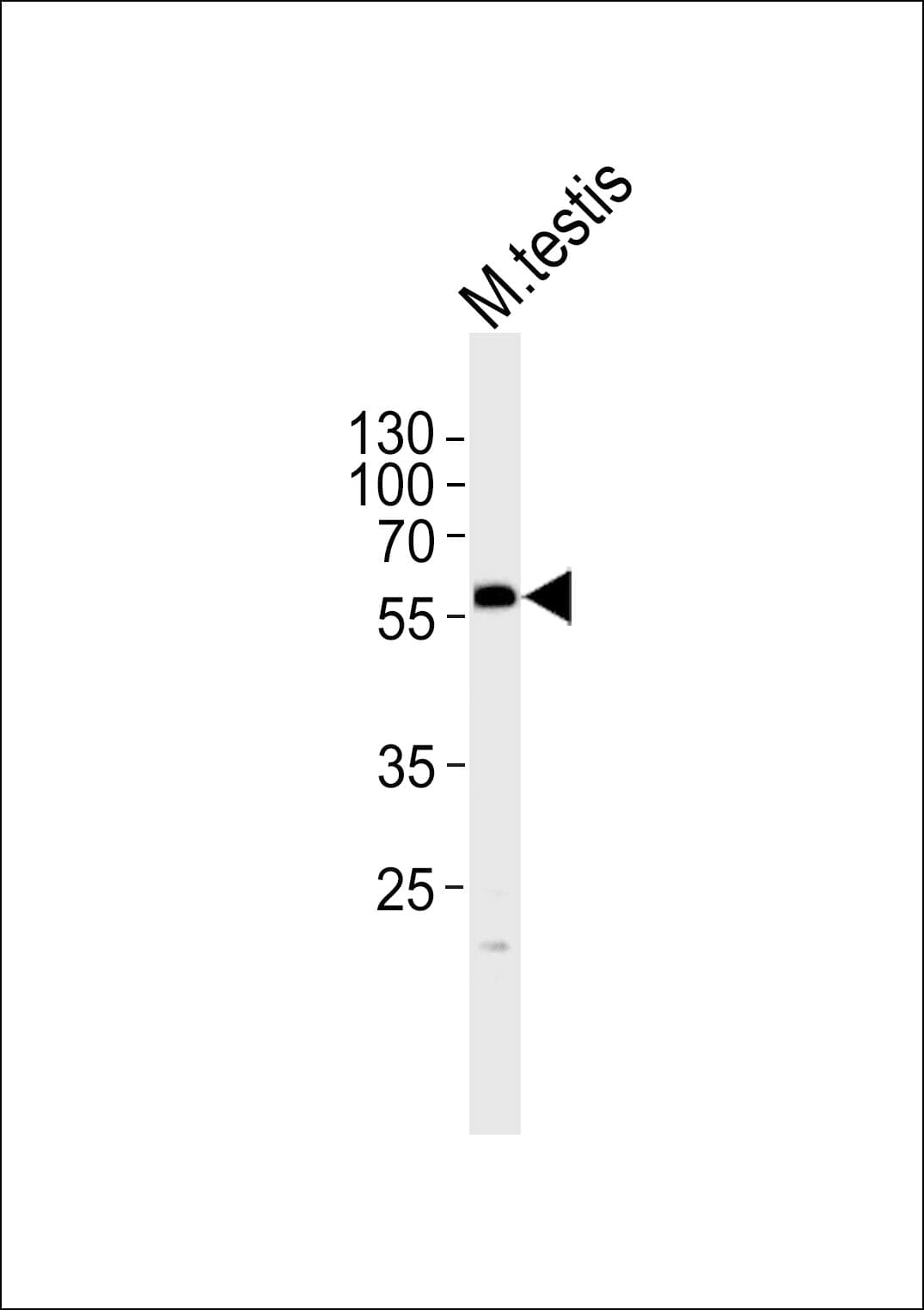 Polyclonal Rabbit anti-Human PHF1 Antibody (aa164-197, WB)