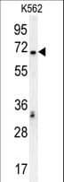Polyclonal Rabbit anti-Human TCF4 Antibody (aa48-73, WB)