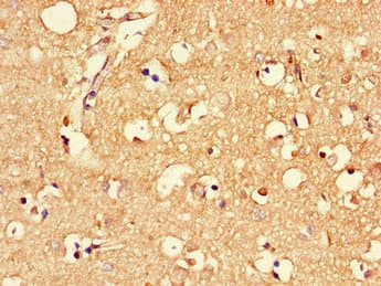 MLC1 / MLC Antibody