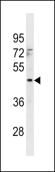 MTCH1 Antibody (aa151-177)