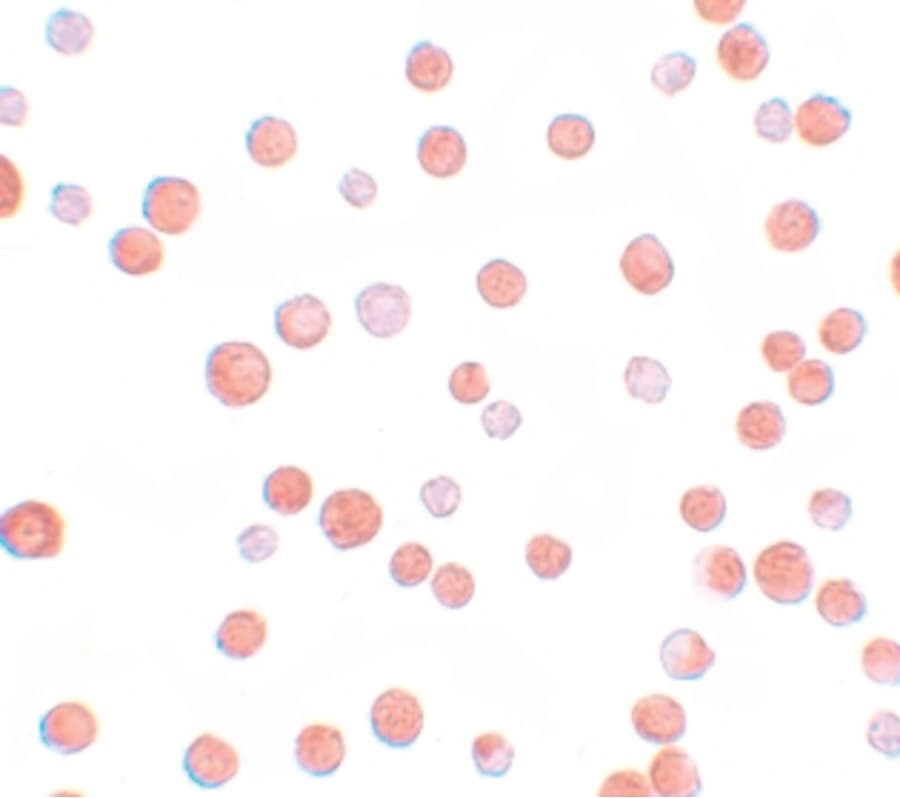 IHC-plus™ Polyclonal Rabbit anti-Human TCF12 / HEB Antibody (IHC, WB)