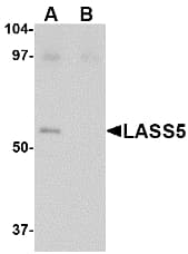 IHC-plus™ LASS5 Antibody