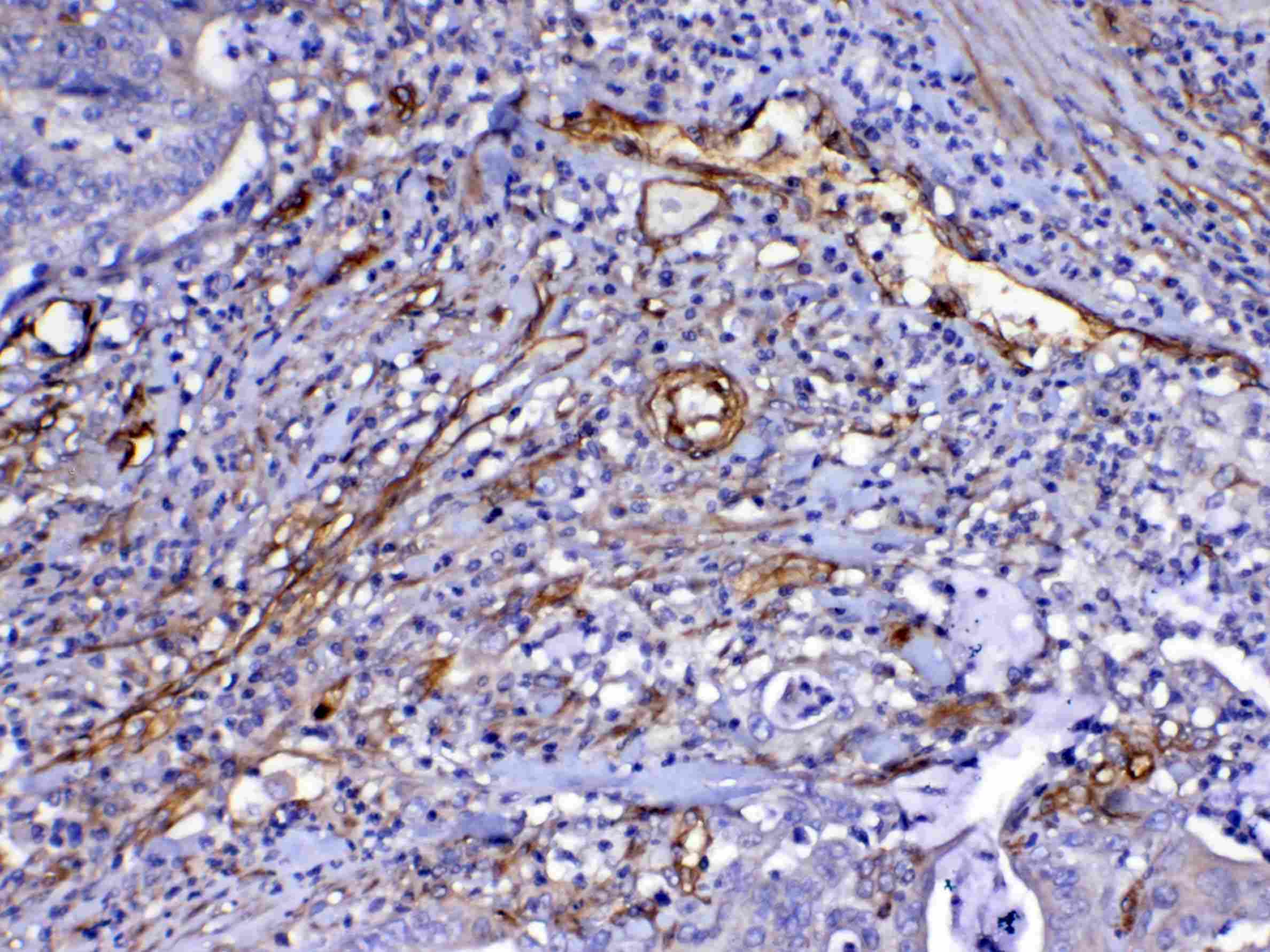 Polyclonal Rabbit anti-Human FLT4 / VEGFR3 Antibody (IHC, WB)