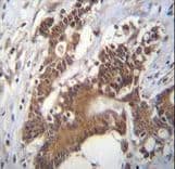 PCYT1A / CCT Alpha Antibody (aa27-54)