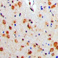 ARRB1 / Beta Arrestin 1 Antibody (C-Terminus)