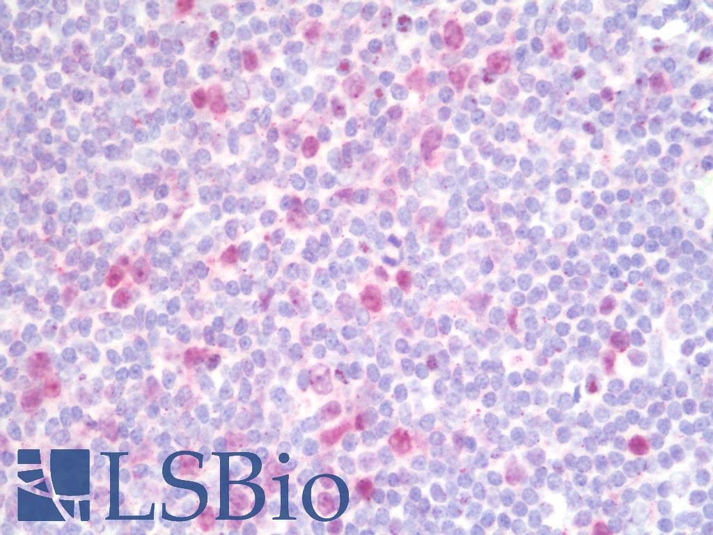 IHC-plus™ LPIN1 / Lipin 1 Antibody