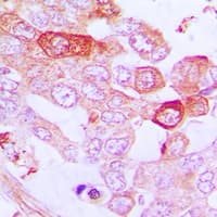 TNFAIP3 / A20 Antibody (Internal)