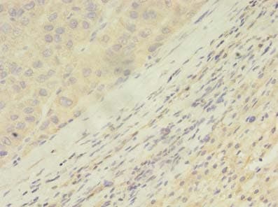 Polyclonal Rabbit anti-Human ARHGAP25 Antibody (IHC)