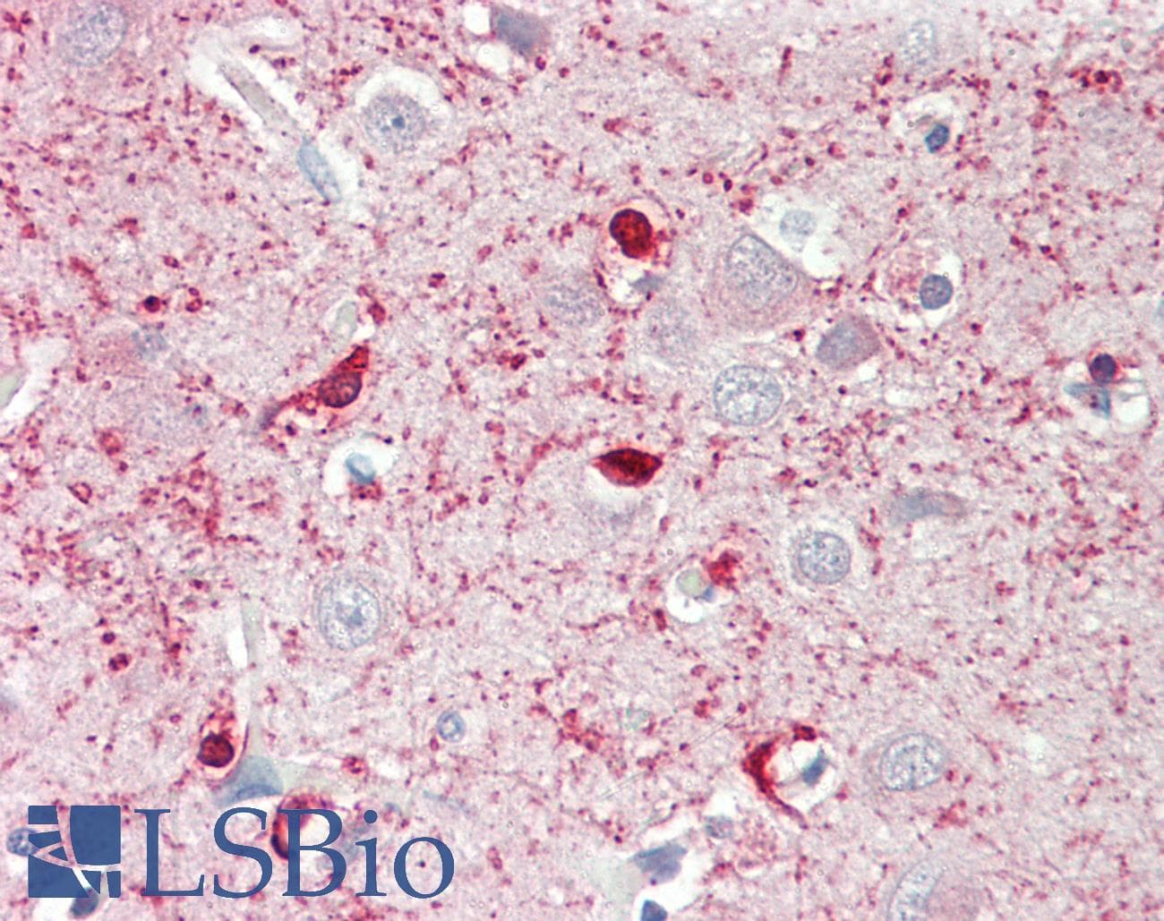 IHC-plus™ MED24 / TRAP100 Antibody (aa801-850)