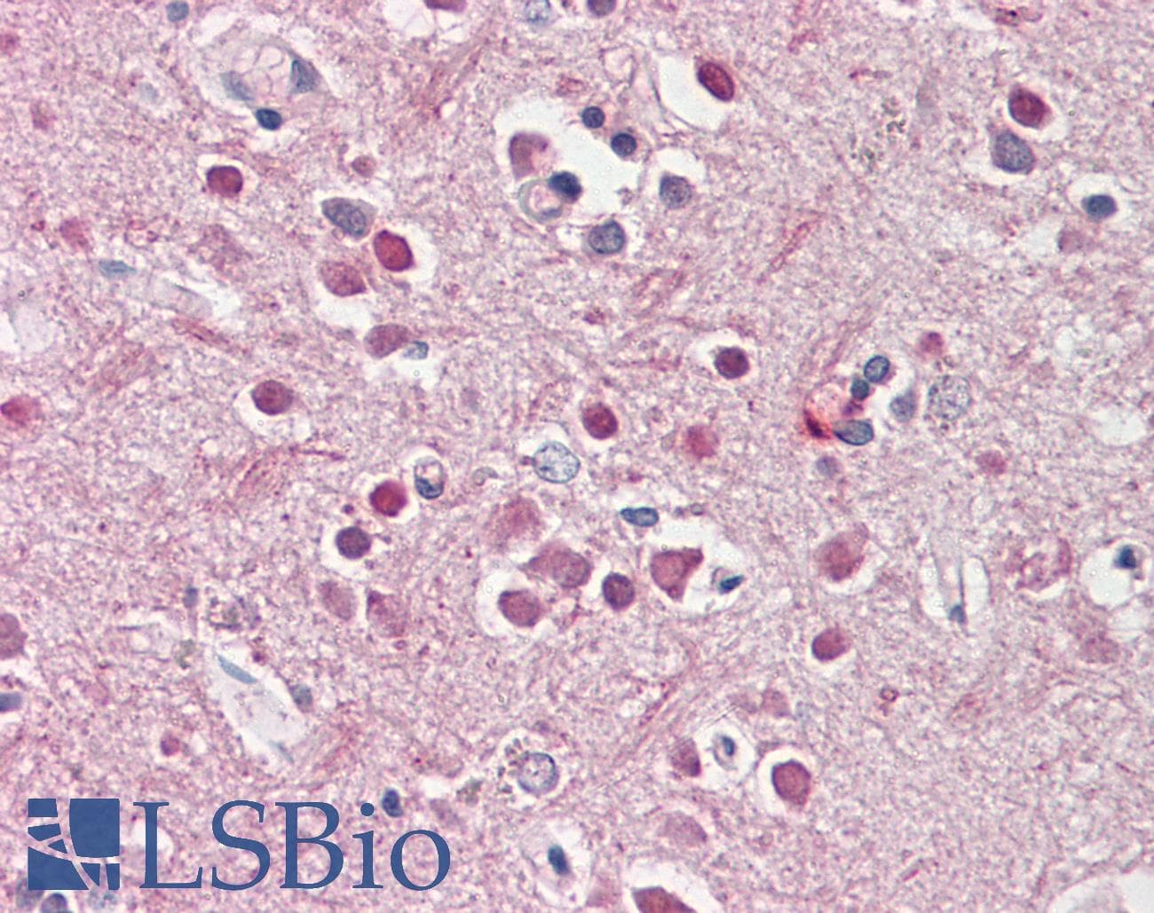 IHC-plus™ CHRNB2 Antibody (aa351-362)