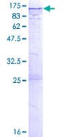 Human EML1 / EMAP Protein (Recombinant GST)