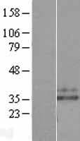 HNE / Neutrophil Elastase Protein (Over-Expression Lysate Myc-DDK (Flag))