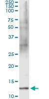 FABP1 / L-FABP Antibody (clone 4G5)
