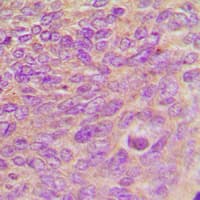 Polyclonal Rabbit anti-Human ARHGEF7 Antibody (Internal, IHC, WB)