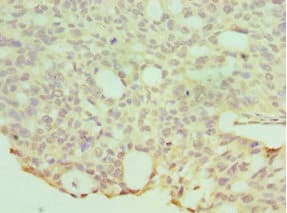 Polyclonal Rabbit anti-Human HYAL1 Antibody (aa136-435, IHC, WB)