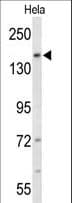FAD104 / FNDC3B Antibody (aa176-205)