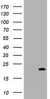 CDKN2C / p18 INK4c Antibody (clone OTI6B3)