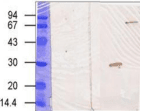 Monoclonal Mouse anti-Human TGM3 / Transglutaminase 3 Antibody (clone C2D, WB)
