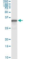 NQO1 Antibody (clone 1E3-A6)