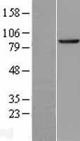 SEC63 Protein (Over-Expression Lysate Myc-DDK (Flag))