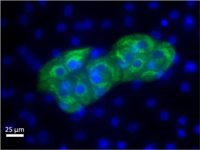 Monoclonal Mouse anti-Human Alpha-Fetoprotein Antibody (clone F1-6P2A8-P2B9A9, IF, WB)