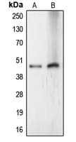 Polyclonal Rabbit anti-Human LASS4 Antibody (Internal, WB)