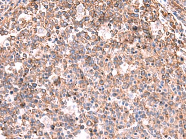 Polyclonal Rabbit anti-Human KBTBD11 Antibody (IHC)