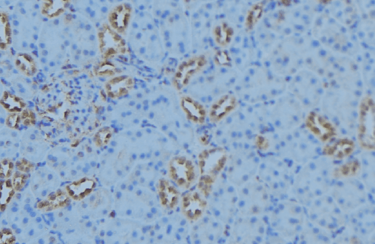 AGXT2 Antibody