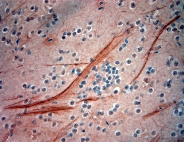 NEFH / NF-H Antibody (aa150-200)