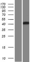 CHST5 Protein (Over-Expression Lysate Myc-DDK (Flag))