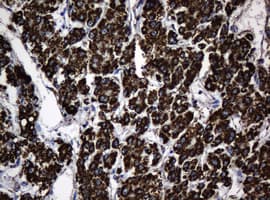 HSPD1 / HSP60 Antibody (clone OTI3G1)