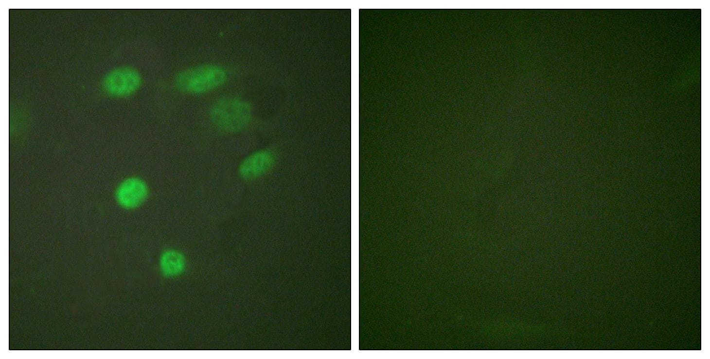 Polyclonal Rabbit anti-Human APC6 / CDC16 Antibody (phospho-Ser560, IHC, IF, WB)