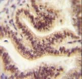 Polyclonal Rabbit anti-Human C16orf45 Antibody (aa86-115, IHC, WB)