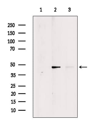 Polyclonal Rabbit anti-Human TRIM11 Antibody (WB)
