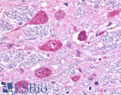 PathPlus™ EDNRA / Endothelin A Receptor Antibody (Extracellular Domain)