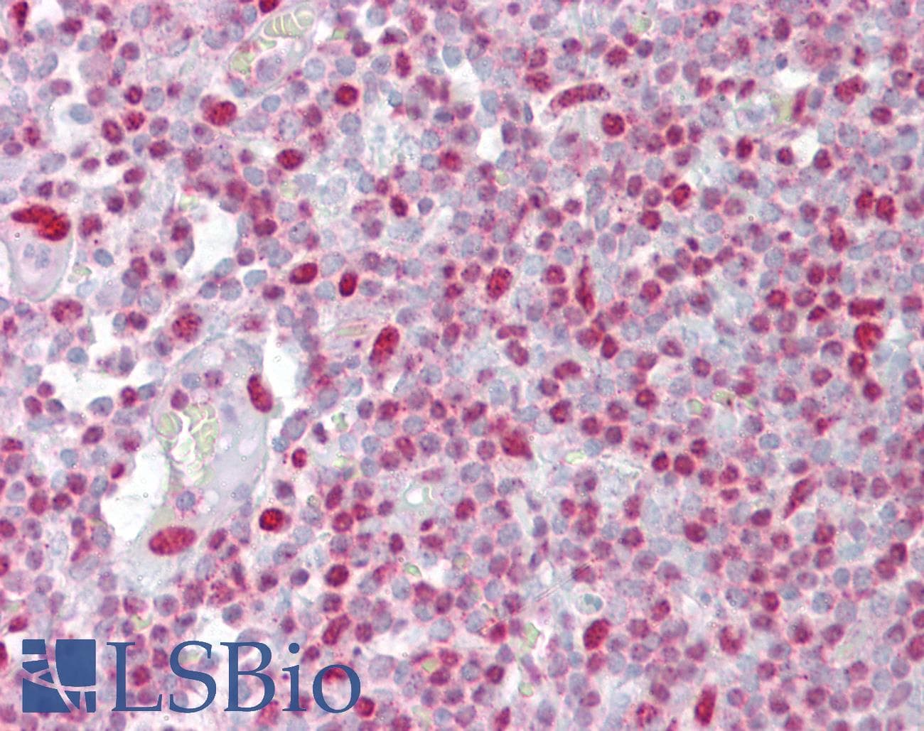 Polyclonal Rabbit anti-Human H2AFX / H2AX Antibody (C-Terminus, IHC, WB)