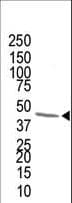 Polyclonal Rabbit anti-Human FDPS Antibody (aa389-419, IHC, WB)