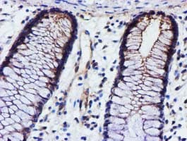 EPN2 Antibody (clone OTI1F5)