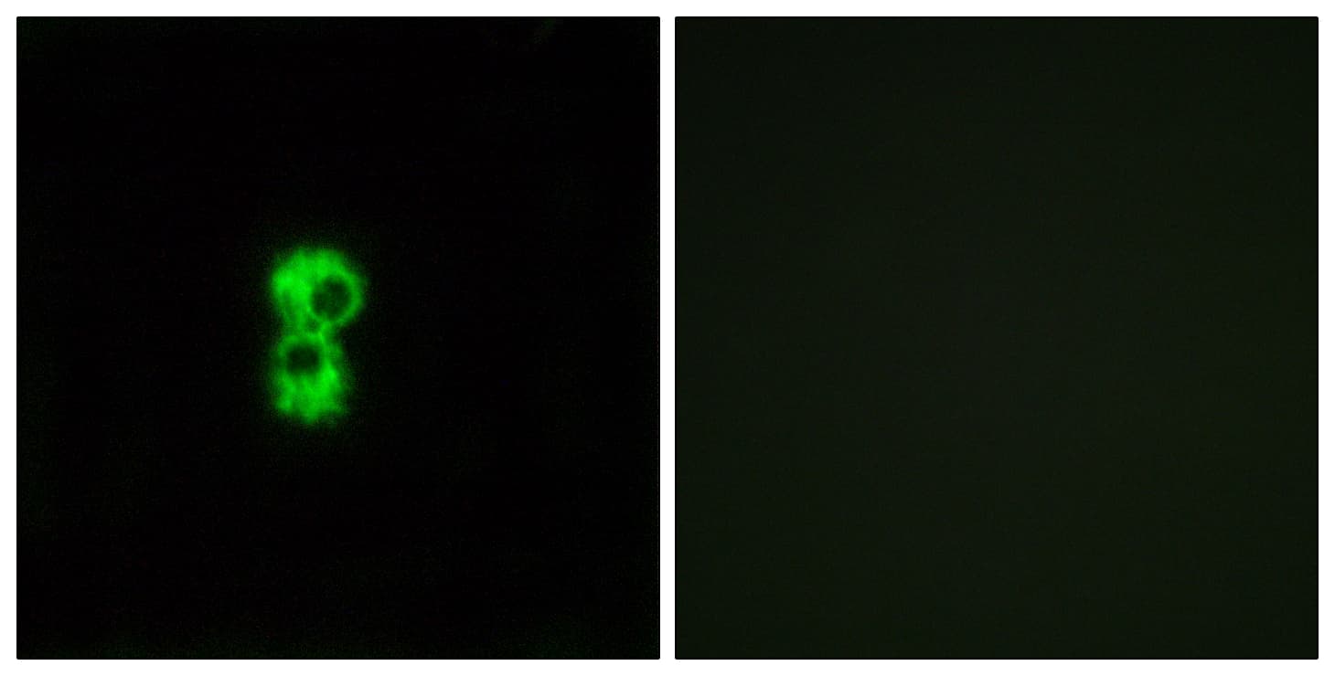 OR1D4+5 Antibody (Internal)