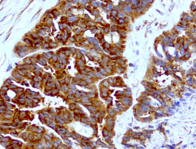 WIBG Antibody (clone UMAB207)
