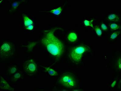 Polyclonal Rabbit anti-Human WWOX Antibody (IHC, WB)