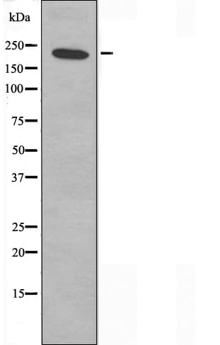 DATF1 / DIDO1 Antibody