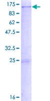 Human SULF2 / Sulfatase 2 Protein (Recombinant GST)
