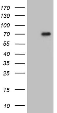 FOXO4 / AFX1 Antibody (aa206-505, clone OTI10G3, Carrier-free)