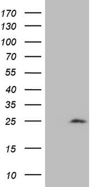 CDKN1A / WAF1 / p21 Antibody (aa2-164, clone OTI6G2)