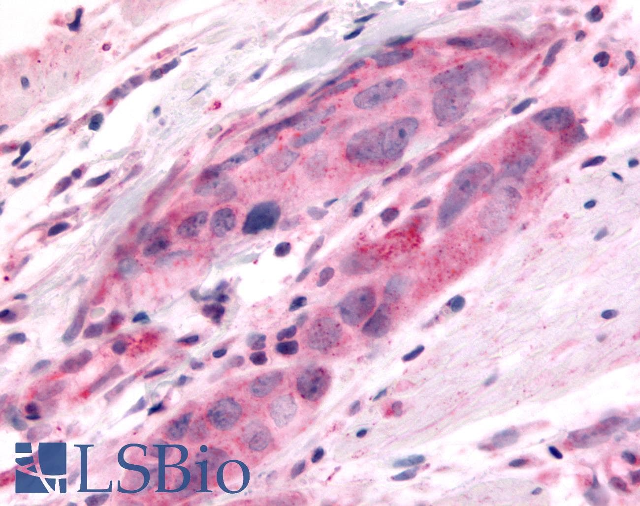 PathPlus™ Polyclonal Rabbit anti-Human DUSP22 / JSP 1 Antibody (Internal, IHC)