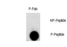 FGFR1 / FGF Receptor 1 Antibody (phospho-Tyr307)