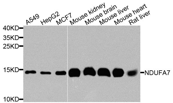 IHC-plus™ NDUFA7 Antibody